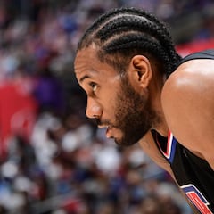 Clippers remain "optimistic" despite Kawhi Leonard injury