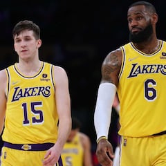 Incendio integral en los Lakers