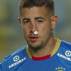 Ensangrentado y desfigurado: así quedó el rostro de Holgado