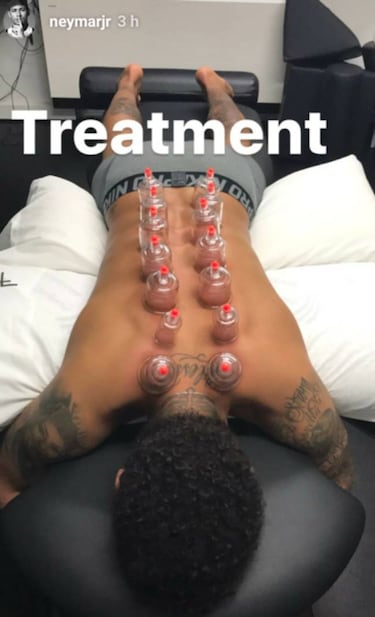 Neymar se recupera usando el método de Michael Phelps