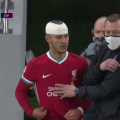 El impactante golpe que dejó a Thiago de esta guisa