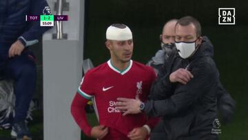 El impactante golpe que dejó a Thiago de esta guisa