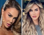 ¿Cuánto cuesta y cómo fue la cirugía de cambio de color de ojos de Ninel Conde?