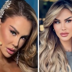 ¿Cuánto cuesta y cómo fue la cirugía de cambio de color de ojos de Ninel Conde?