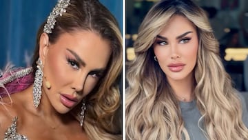 ¿Cuánto cuesta y cómo fue la cirugía de cambio de color de ojos de Ninel Conde?