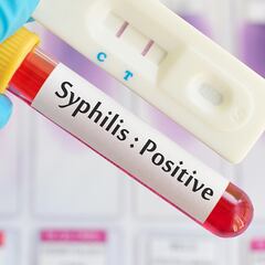 Se disparan las ETS en España: estas son las enfermedades de transmisión sexual más extendidas