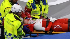 ¡Accidente en los Juegos! Sellier, cortada debajo del ojo por la cuchilla de su rival