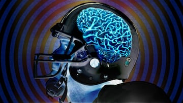 S¨ªntomas de CTE en 99% de exjugadores de la NFL