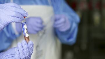 Un sanitario protegido con guantes sostiene un muestra para realizar un Análisis PCR