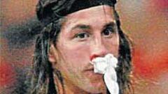 Ramos jugará hasta junio con la nariz rota