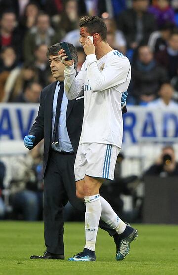 Cristiano Ronaldo recibió un gol en la cara justo cuando anotaba de cabeza el gol 6-1