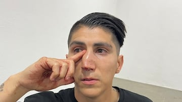 Vídeo: Así fue la brutal pelea que tuvo el hermano de Ángel Zaldívar en el Akron