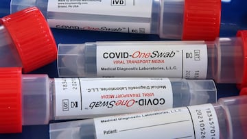 11 July 2020, US, Kissimmee: A general view of swab samples collected from people at a drive-through coronavirus (COVID-19) testing unit inside the parking lot of Osceola Heritage Park. Photo: Paul Hennessy/SOPA Images via ZUMA Wire/dpa
11/07/2020 ON