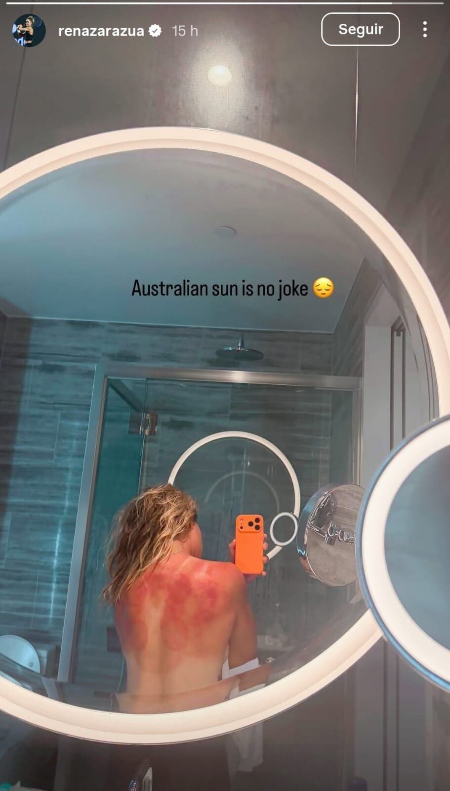 La tenista mexicana Renata Zarazúa muestra las quemaduras en la espalda a causa del sol en el torneo de Hobart (Australia).