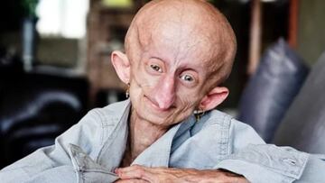 Muere la influencer Beandri Booysen a los 19 años