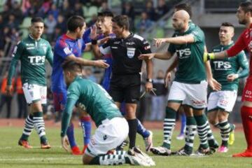 Wanderers - Universidad de Chile, en imágenes