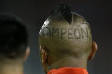 El jugador de Chile Arturo Vidal es fotografiado antes del partido clasificatorio al mundial de Rusia 2018 contra Bolivia disputado en el estadio Monumental de Santiago, Chile. 