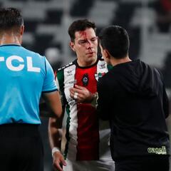 La patada que provocó una expulsión en Colo Colo y que dejó sangrando al rival