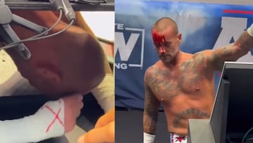 Video de CM Punk autolesionándose con una navaja se hace viral 