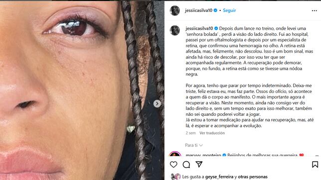 Portugal, lastrada: “Sigo con ver por el lado derecho”