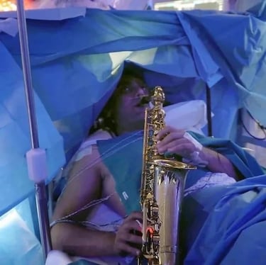 Despierto en plena operación de cerebro: el curioso método para no fallar una craneotomía