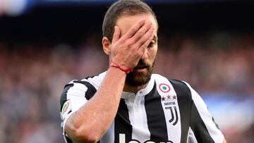 Higuaín fue operado de la mano y no estará ante el Napoli