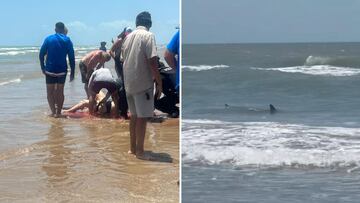 Shark attack in Texas caught on video: woman’s leg severely injured, hospitalized