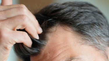 Champú Pilexil anticaída de uso diario: la solución a la pérdida de pelo