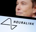 El primer chip cerebral de Neuralink (Elon Musk) puede controlar un ratón con el pensamiento