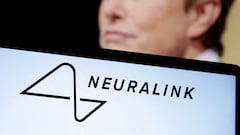 El primer chip cerebral de Neuralink (Elon Musk) puede controlar un ratón con el pensamiento