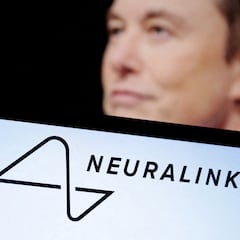 Implantan el chip cerebral de Elon Musk a un paciente de Miami: “Me están devolviendo la chispa”