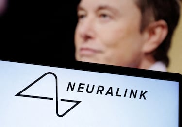 La lista de espera para implantarse un Neuralink explota tras esta gesta de un hombre con esclerosis