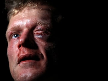 El BKB (Bare-knuckle boxing) es el deporte del boxeo sin el uso de guantes de boxeo u otro acolchado en las manos de los participantes.