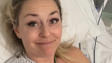 La esquiadora estadounidense Lindsey Vonn, en el hospital de Treviso tras su dura caída en los Juegos Olímpicos