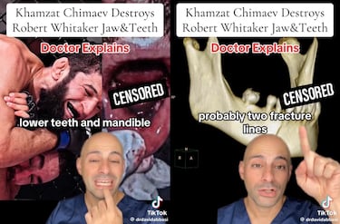 El destrozo de Chimaev a Whittaker: ¡°Le van a tener que sujetar la boca con alambres¡±