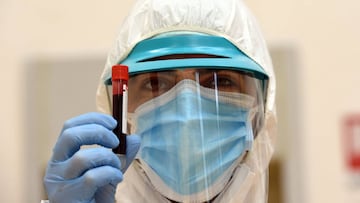 Un profesional de la salud muestra un tubo de ensayo con sangre para una prueba serol&oacute;gica que puede identificar qui&eacute;n contrajo el coronavirus. Mila, Italia, 2020. 