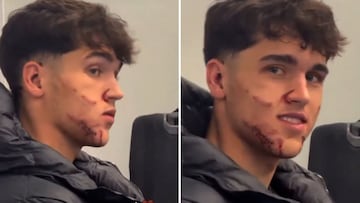 Da miedo verlo: así ha quedado la cara de Cubarsí