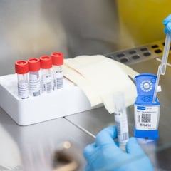 El proyecto español con linfocitos T para curar el coronavirus