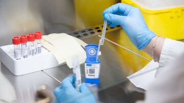 Una investigadora trabaja en el laboratorio de Microbiología del Hospital Universitario de Badajoz.