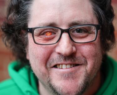 El amor a unos colores va mucho más allá de una  simple camiseta o una bufanda. Algunos eligen llevar el escudo de su club tatuado en la piel y otros van  un paso más allá. El protagonista de la foto, hicha del United, vio el partido de vuelta de los cuartos de final de la Europa League, contra el Olympique de Lyon, con una lentilla de los Diablos Rojos en un ojo.