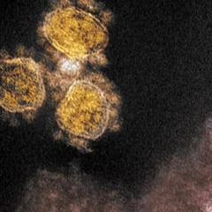 Descubren una forma de transmisión del coronavirus hasta ahora desconocida