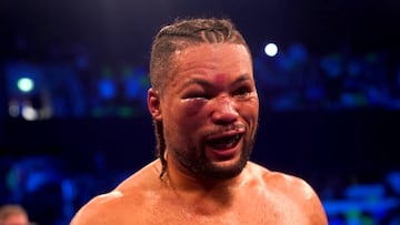 El ojo de Joe Joyce después de perder su cinturón Interino OMB ante Zhilei Zhang.