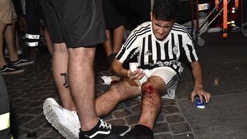 Football Soccer - Juventus v Real Madrid - UEFA Champions League Final - San Carlo Square, Turin, Italy - June 3, 2017 A Juventus' fan sits injured as the fans gathered in San Carlo Square run away following panic created by the explosion of firecrackers as they was watching the match on a giant screen. REUTERS/Giorgio Perottino