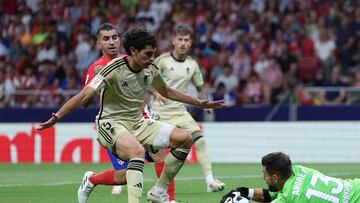 Vallejo jugó tocado ante el Atlético con una venda en su pierna izquierda.