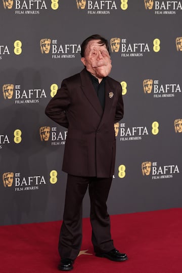 Adam Pearson posa en la alfombra roja de los premios BAFTA 2025 celebrados en el Royal Festival Hall del Southbank Centre de Londres.