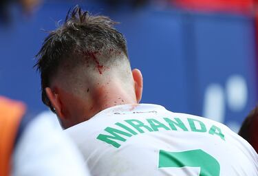 Duele con solo verlo: la acción por la que Moncayola vio la roja directa