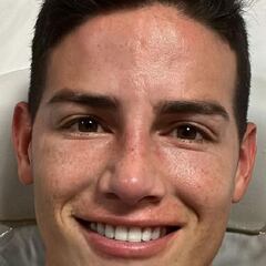 James y las marcas del golpe: nariz, mandíbula y costilla