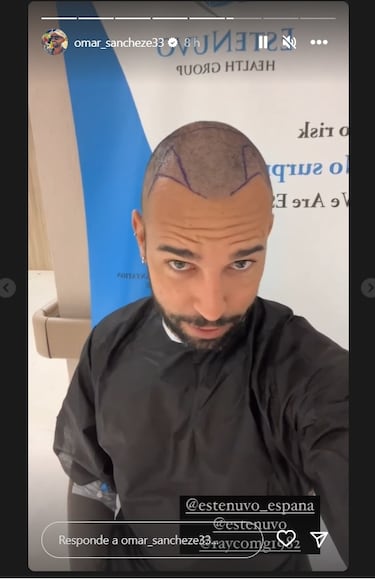 El último retoque estético de Omar Sánchez por el que ha viajado a Turquía