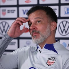 Anthony Hudson confía en vencer a México pese a no contar con sus estrellas en el USMNT