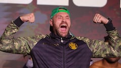 El campeón de los pesos pesados del Consejo Mundial de Boxeo (CMB) Tyson Fury.